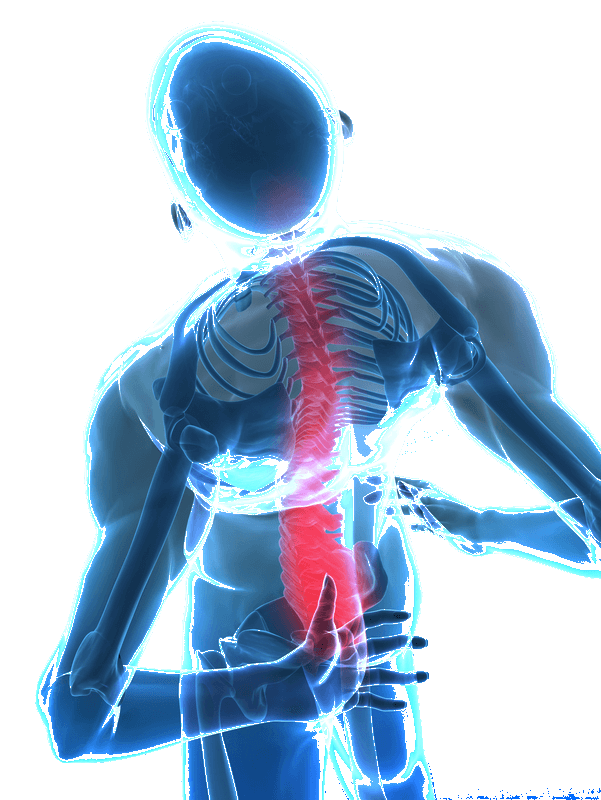 complex de dureri de spate