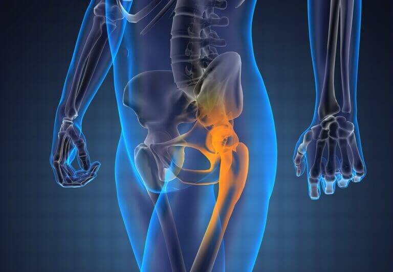 artroza deformantă a semnelor radiologice ale șoldului durere în articulația piciorului pe cot